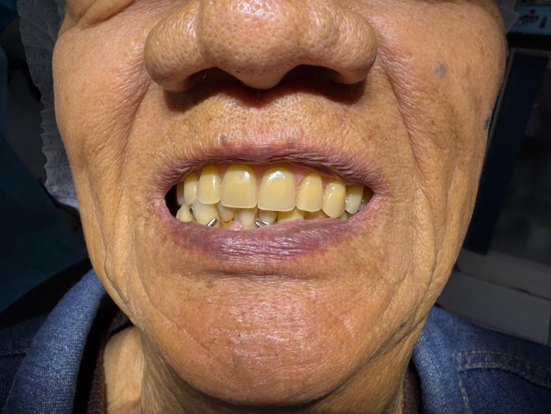 Registro inicial do sorriso
